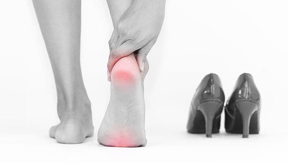 Das Tragen enger Schuhe ist die Ursache für Mykose. 