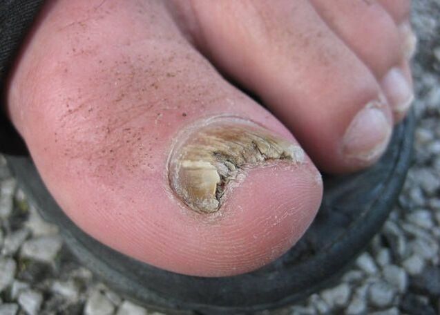 Das Ergebnis der Vernachlässigung