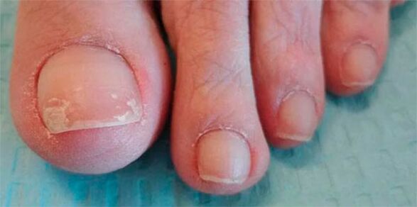 Phasen von Pilzbeinen