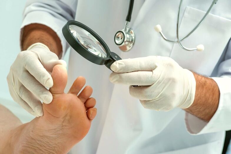 Dermatologe untersucht Zehennägel