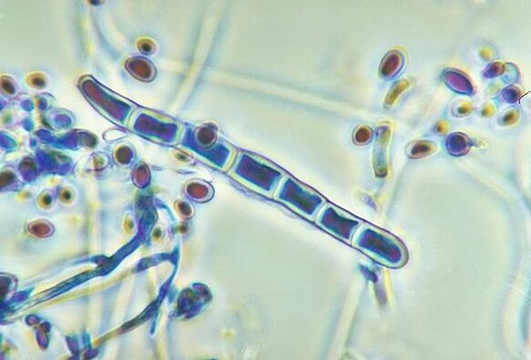 Pilz Trichophyton rubrum unter dem Mikroskop