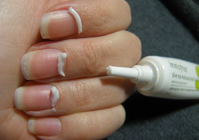 Behandlung von Nagelpilz mit Salbe